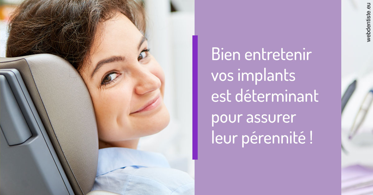 https://dr-julien-buffet.chirurgiens-dentistes.fr/Entretien implants 1