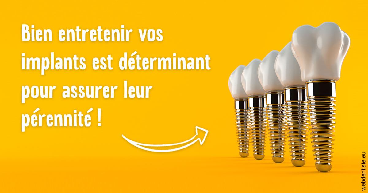 https://dr-julien-buffet.chirurgiens-dentistes.fr/Entretien implants 2