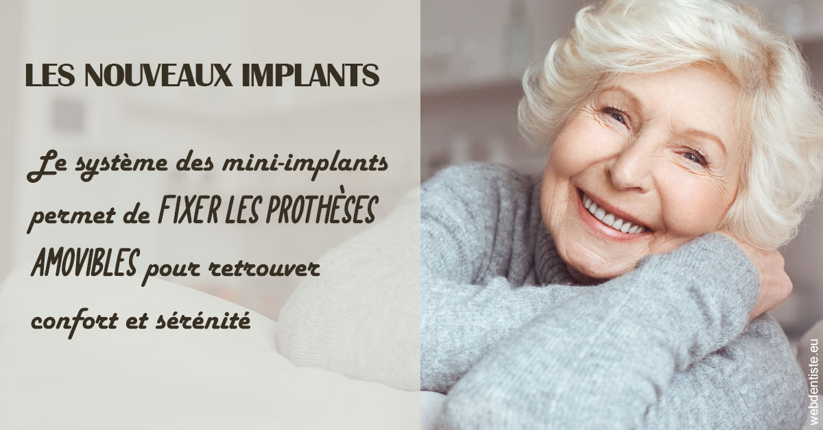 https://dr-julien-buffet.chirurgiens-dentistes.fr/Les nouveaux implants 1