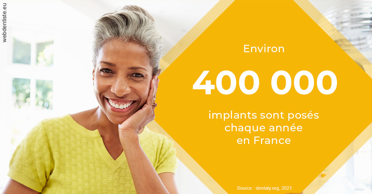 https://dr-julien-buffet.chirurgiens-dentistes.fr/Pose d'implants en France