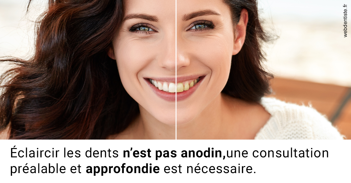https://dr-julien-buffet.chirurgiens-dentistes.fr/Le blanchiment 2