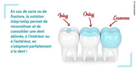 https://dr-julien-buffet.chirurgiens-dentistes.fr/L'INLAY ou l'ONLAY