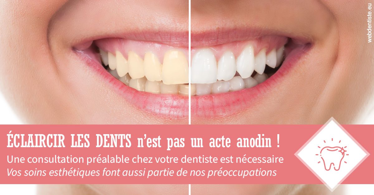 https://dr-julien-buffet.chirurgiens-dentistes.fr/Eclaircir les dents 1