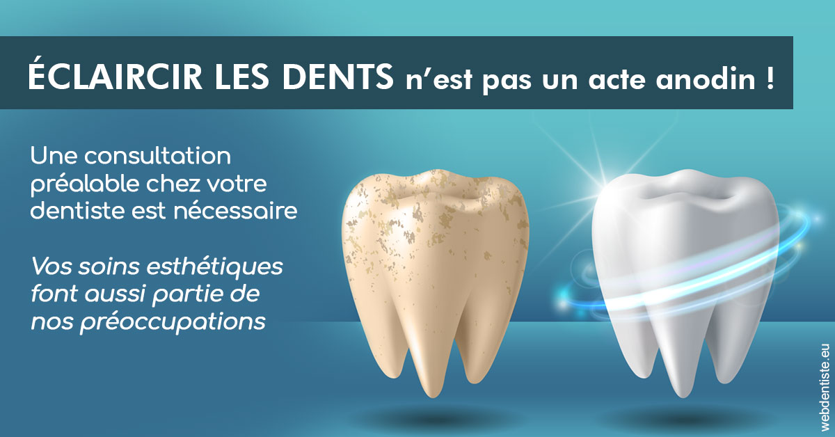 https://dr-julien-buffet.chirurgiens-dentistes.fr/Eclaircir les dents 2