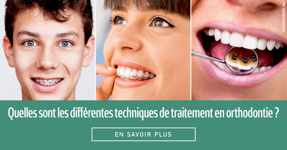 https://dr-julien-buffet.chirurgiens-dentistes.fr/Les différentes techniques de traitement 2