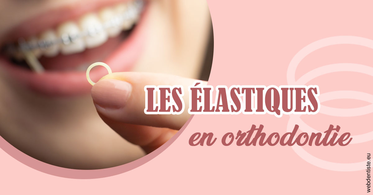 https://dr-julien-buffet.chirurgiens-dentistes.fr/Elastiques orthodontie 1