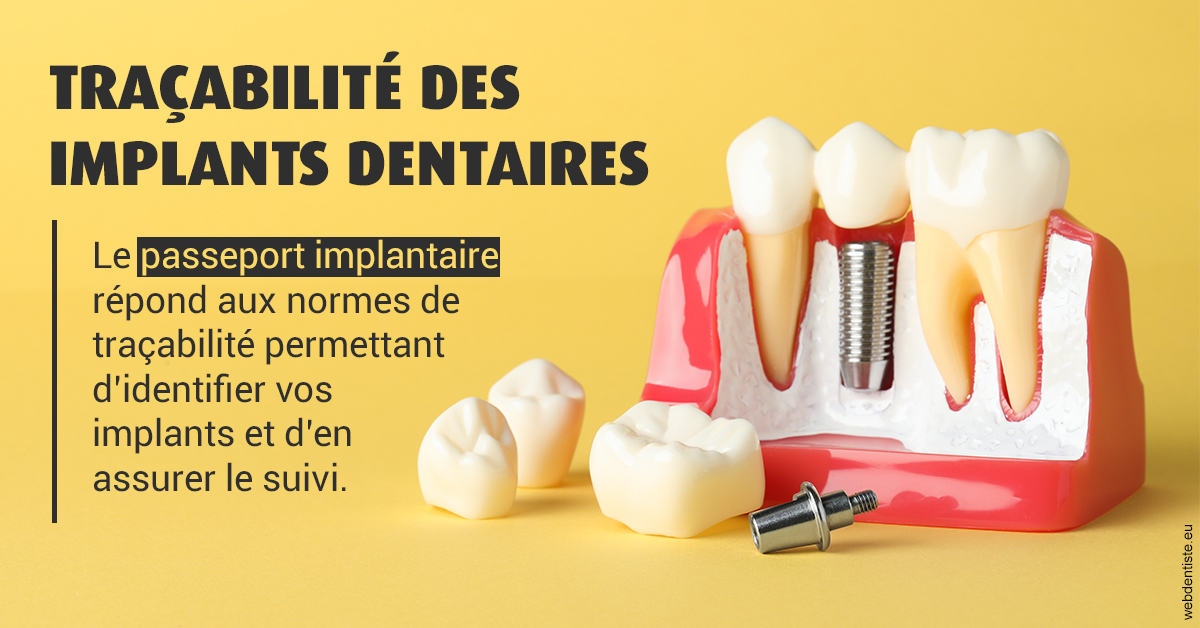 https://dr-julien-buffet.chirurgiens-dentistes.fr/T2 2023 - Traçabilité des implants 2