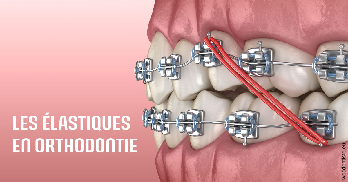 https://dr-julien-buffet.chirurgiens-dentistes.fr/Elastiques orthodontie 2