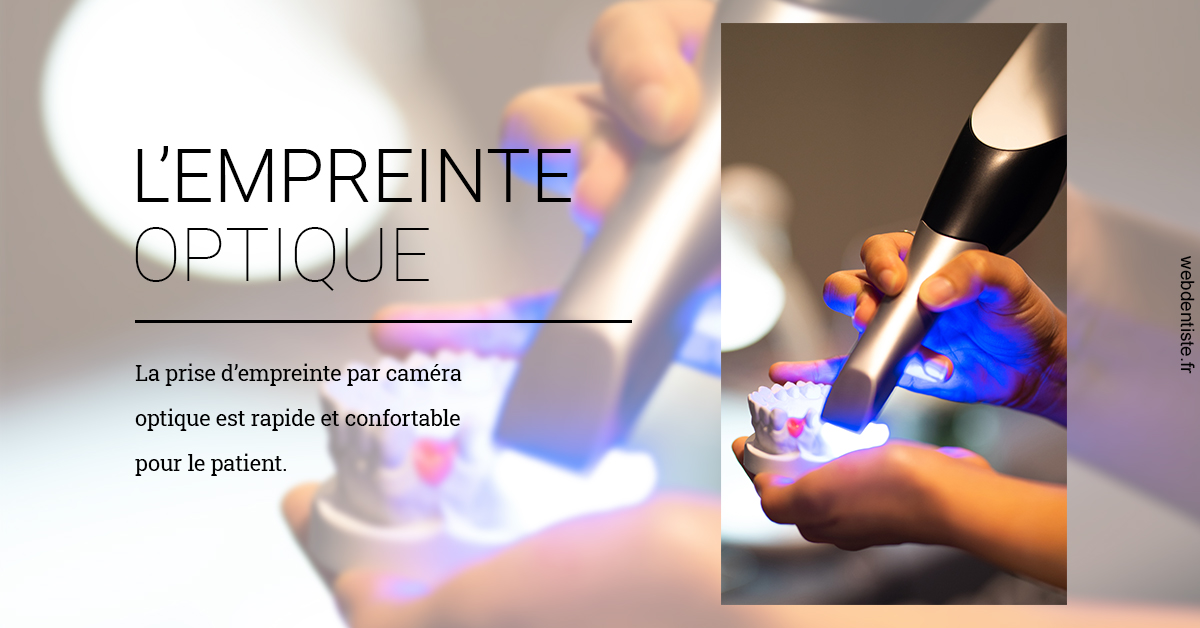 https://dr-julien-buffet.chirurgiens-dentistes.fr/L'empreinte Optique 2